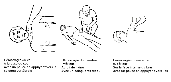 les points de compressions2